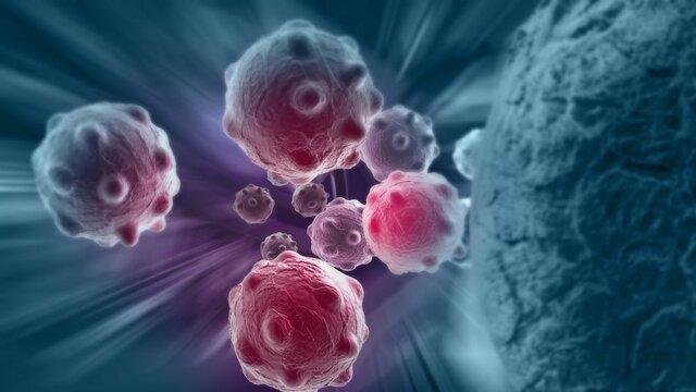 روشی نوین برای نابودی سلول های سرطانی با یاری نانوذرات